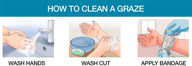 How To Clean A Open Wound