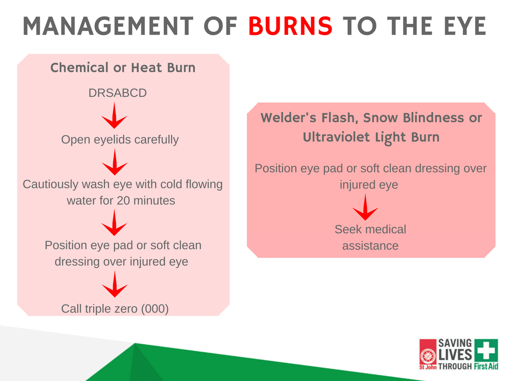 St John Victoria Blog Eye Injury First Aid Tips Learn How To