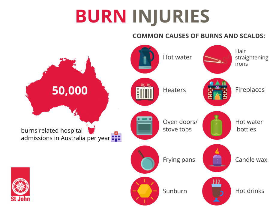 How to Treat & Recognise A Burn